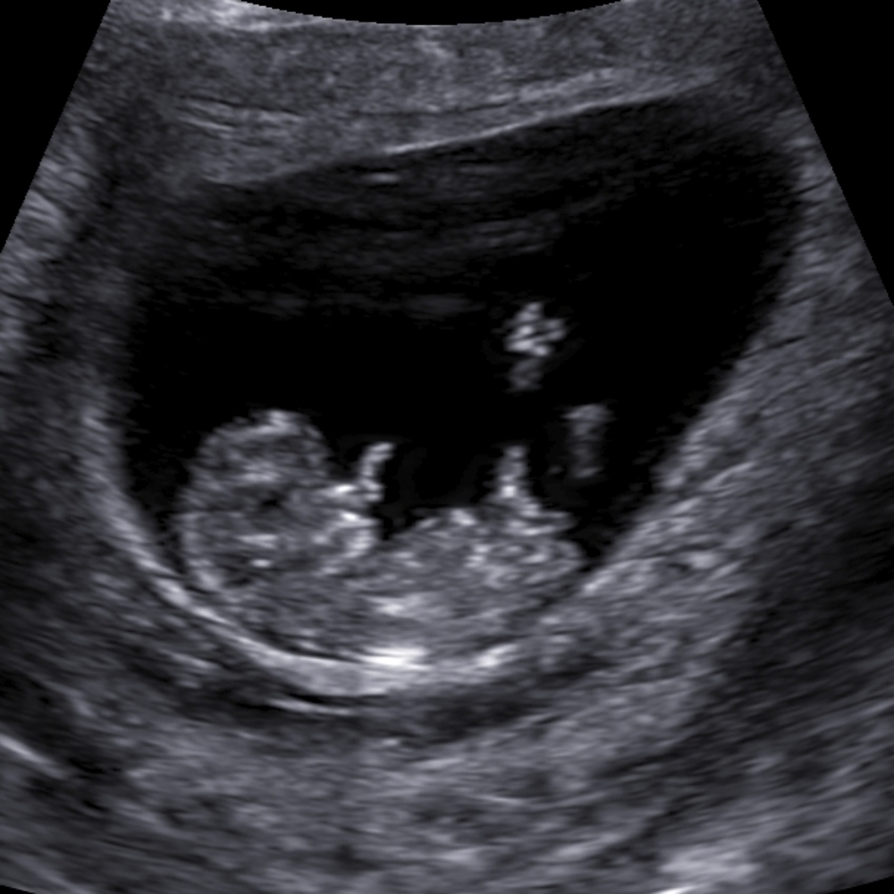 ✨️🎊Life Updates🎊✨️ - Picture 3 of 10